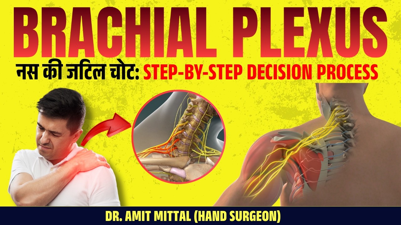 Brachial Plexus Surgery का फैसला कैसे होता है? जानिए पूरा प्रोसेस  | BPI Surgery is truly needed?