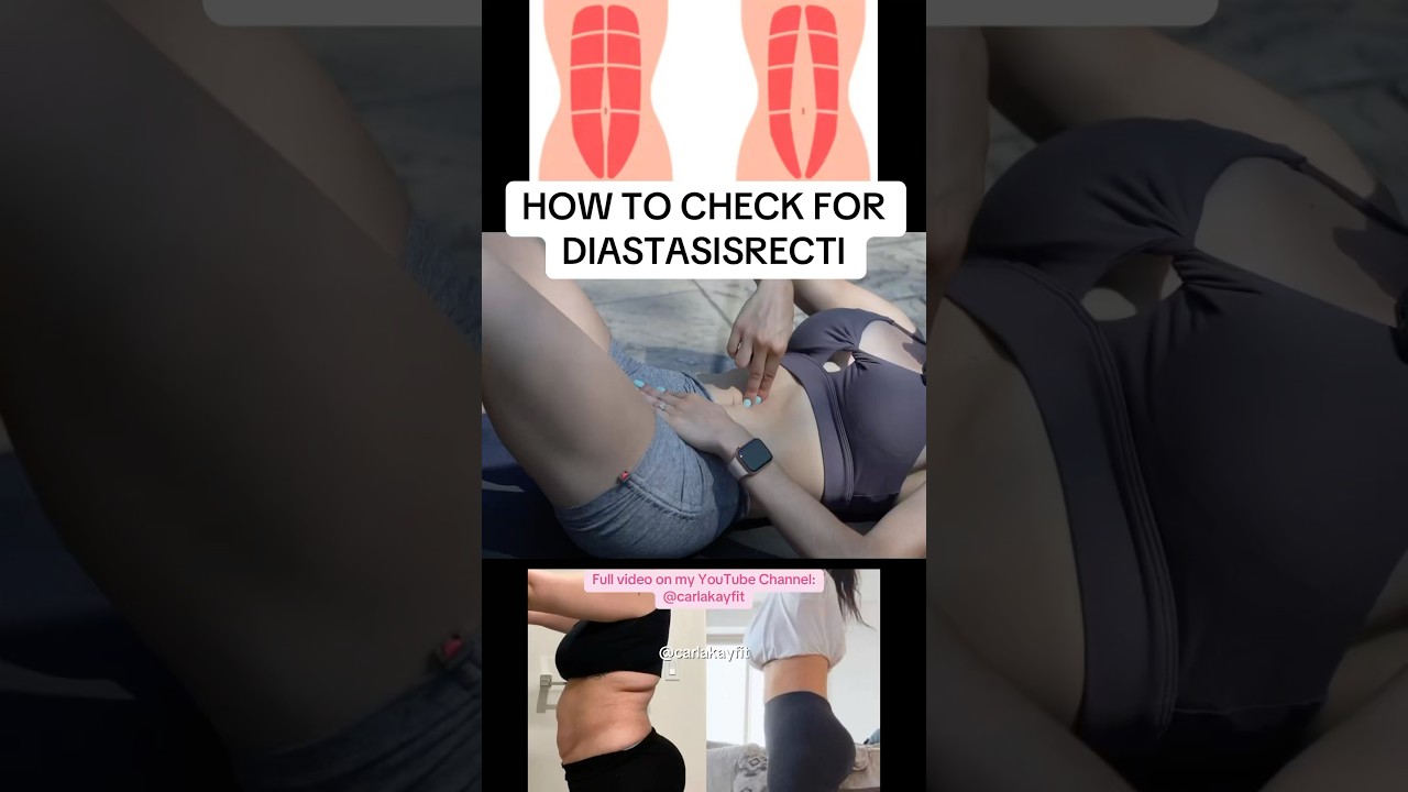 How to Check Your Diastasisrecti at Home🙌🏻✨ 