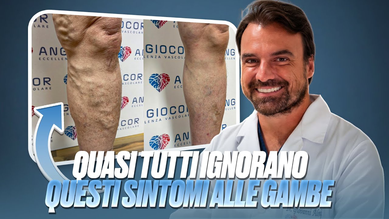 QUASI TUTTI IGNORANO QUESTI SINTOMI ALLE GAMBE: ECCO PERCHÉ È UN ERRORE!