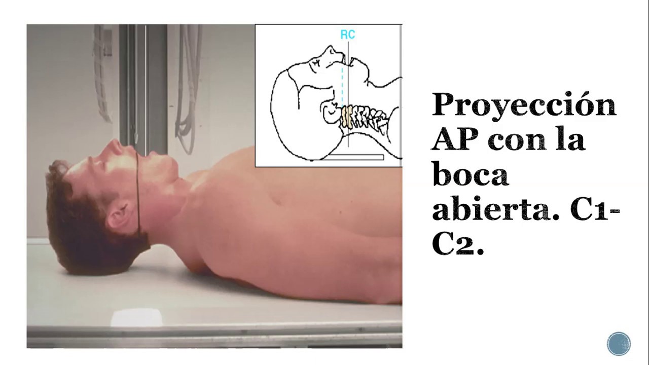 Técnicas II - Proyecciones especiales columna cervical (3ºC Vespertino, Docente Graciela Castillo)