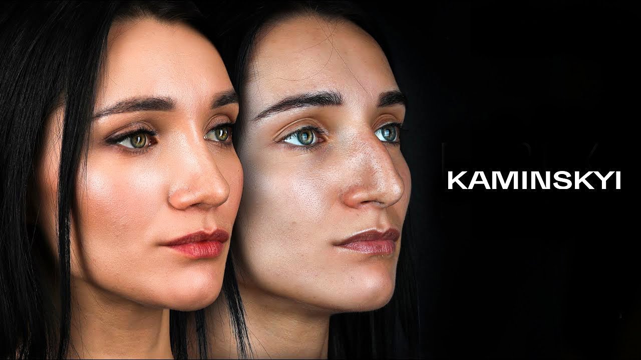 Rinoplastica. Preparazione e risultato dell’intervento ⭕️ KAMINSKYI