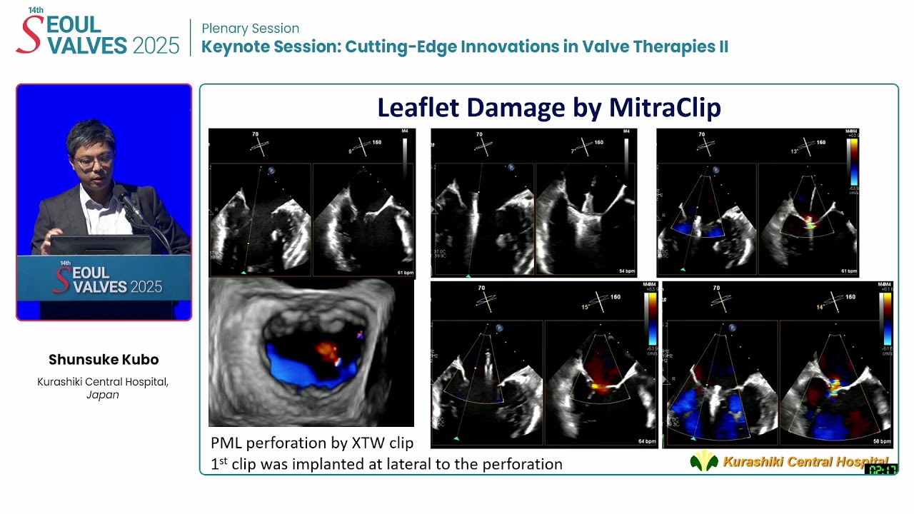 [SEOUL VALVES 2025] Keynote Session: Cutting-Edge Innovations in Valve Therapies II