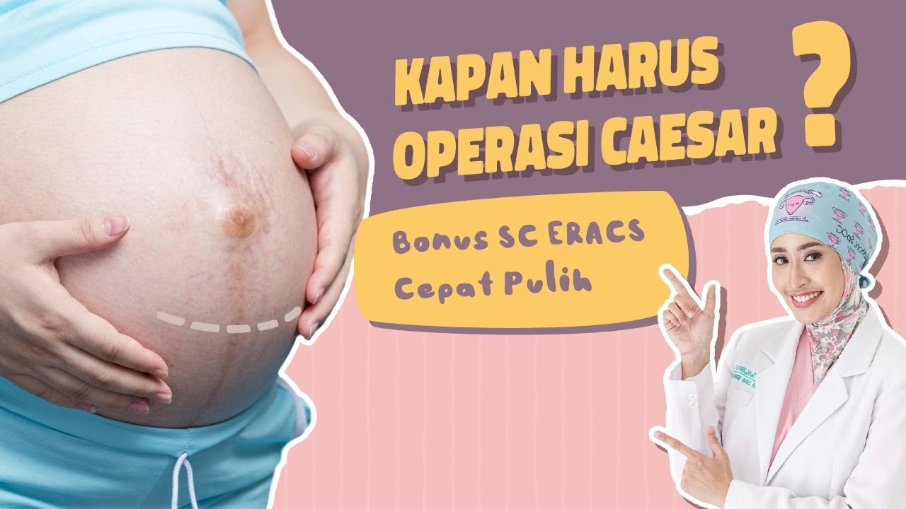 Kapan Sebaiknya Operasi Caesar Dilakukan?