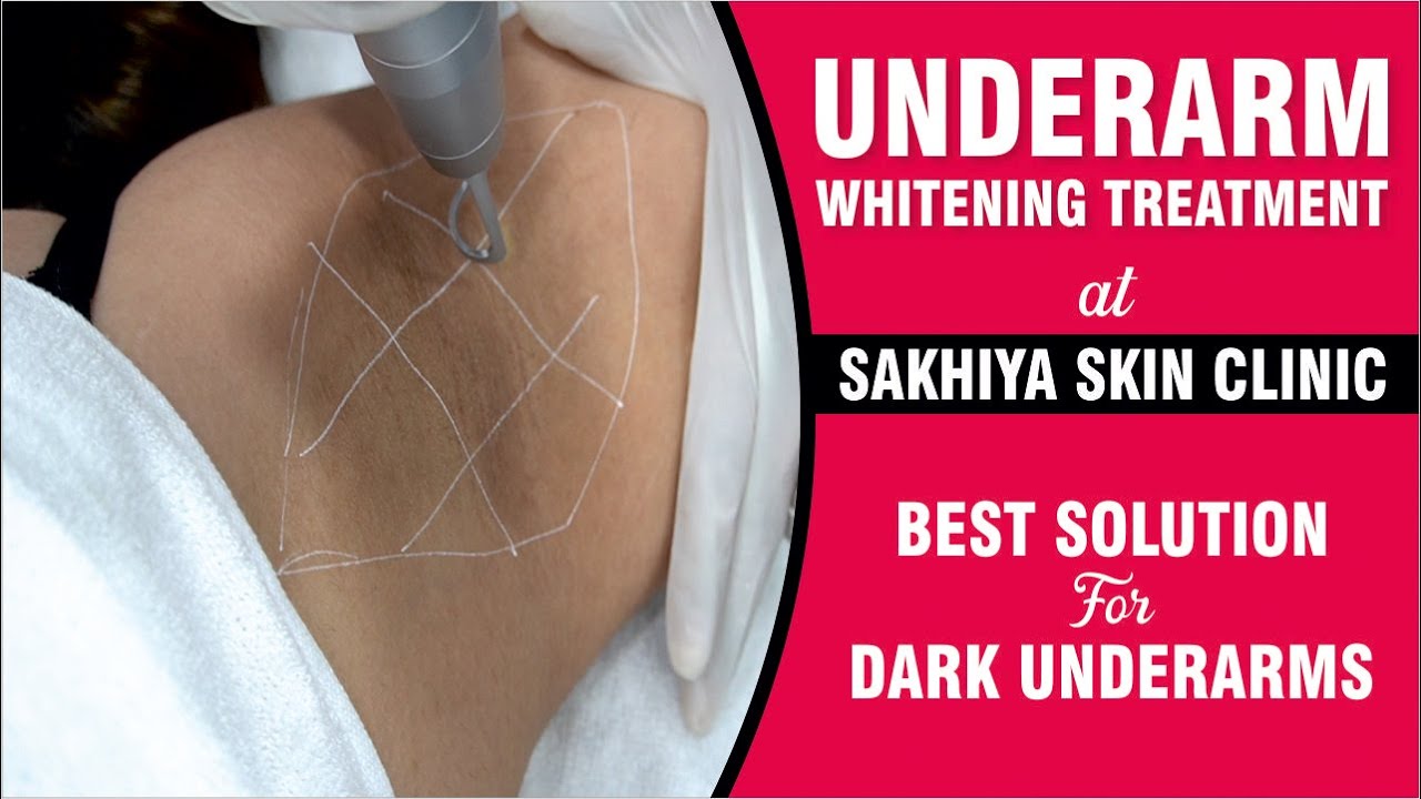 Underarm Whitening Treatment at Sakhiya Skin Clinic | Best Solution for Dark Underarms