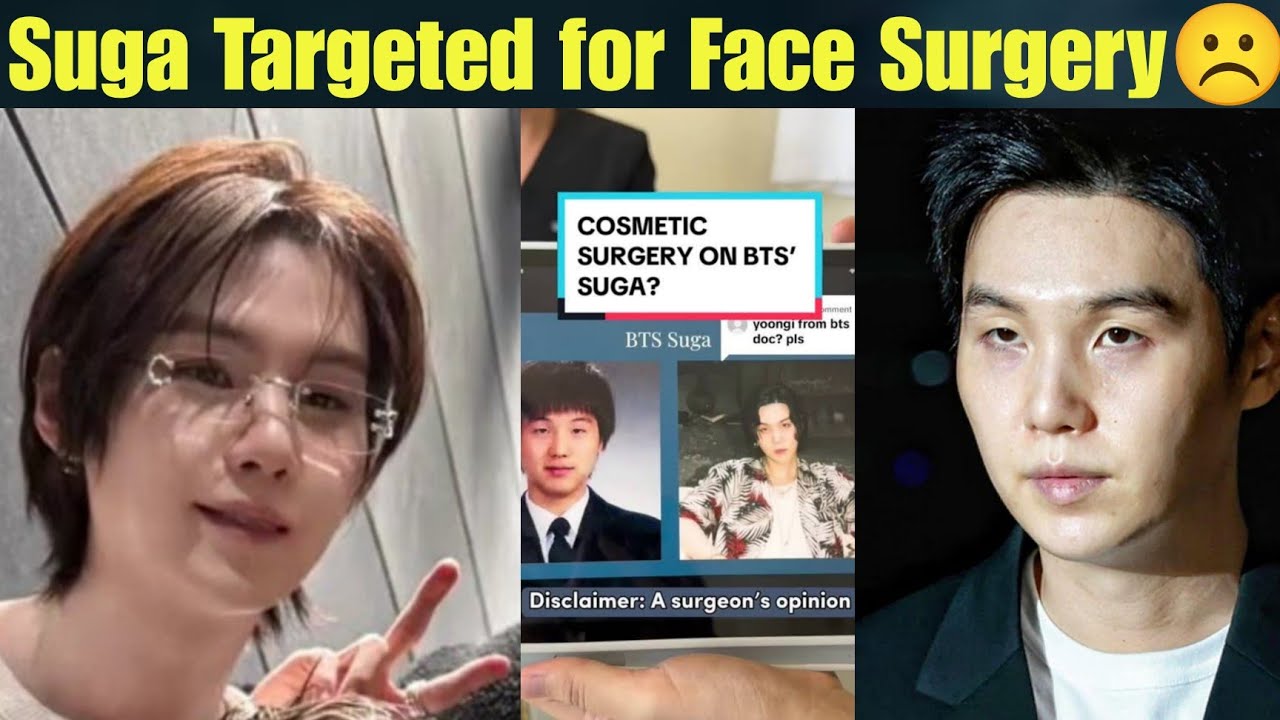 LIVE 🔴 BTS Suga Getting Hate For Face Surgery ☹️ Poor Yoongi Crying 😭 BTS Suga Weird Face #bts #suga