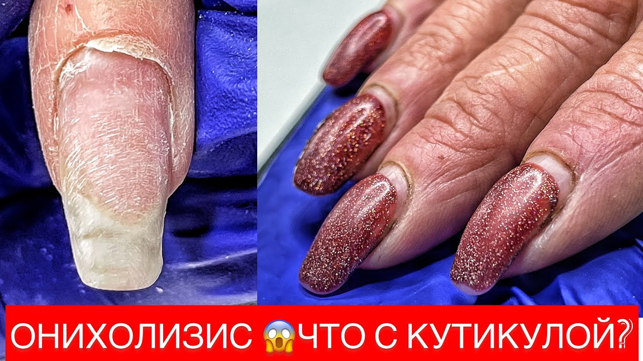 КЛЮЮЩИЕ И СКРУЧЕННЫЕ НОГТИ😵ИСПРАВИМ ?😉 МАНИКЮР МАКРО