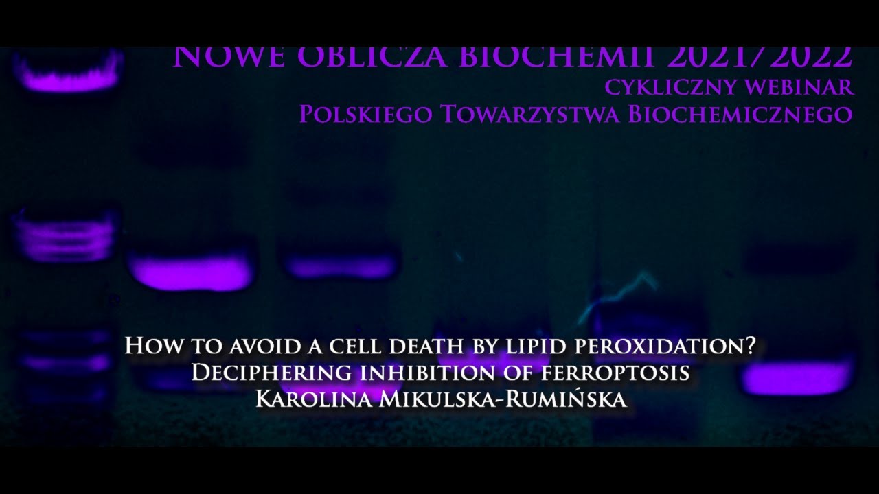 How to avoid a cell death by lipid peroxidation?  - dr Karolina Mikulska-Rumińska