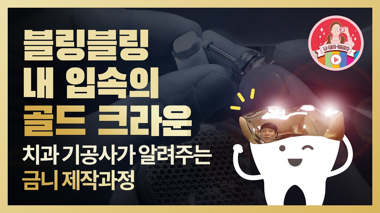 [KBSMC 크리에이터 - Zeus] 치과 기공사가 알려주는 '금니, 이렇게 만든다!'(How to make gold crown) I 강북삼성병원