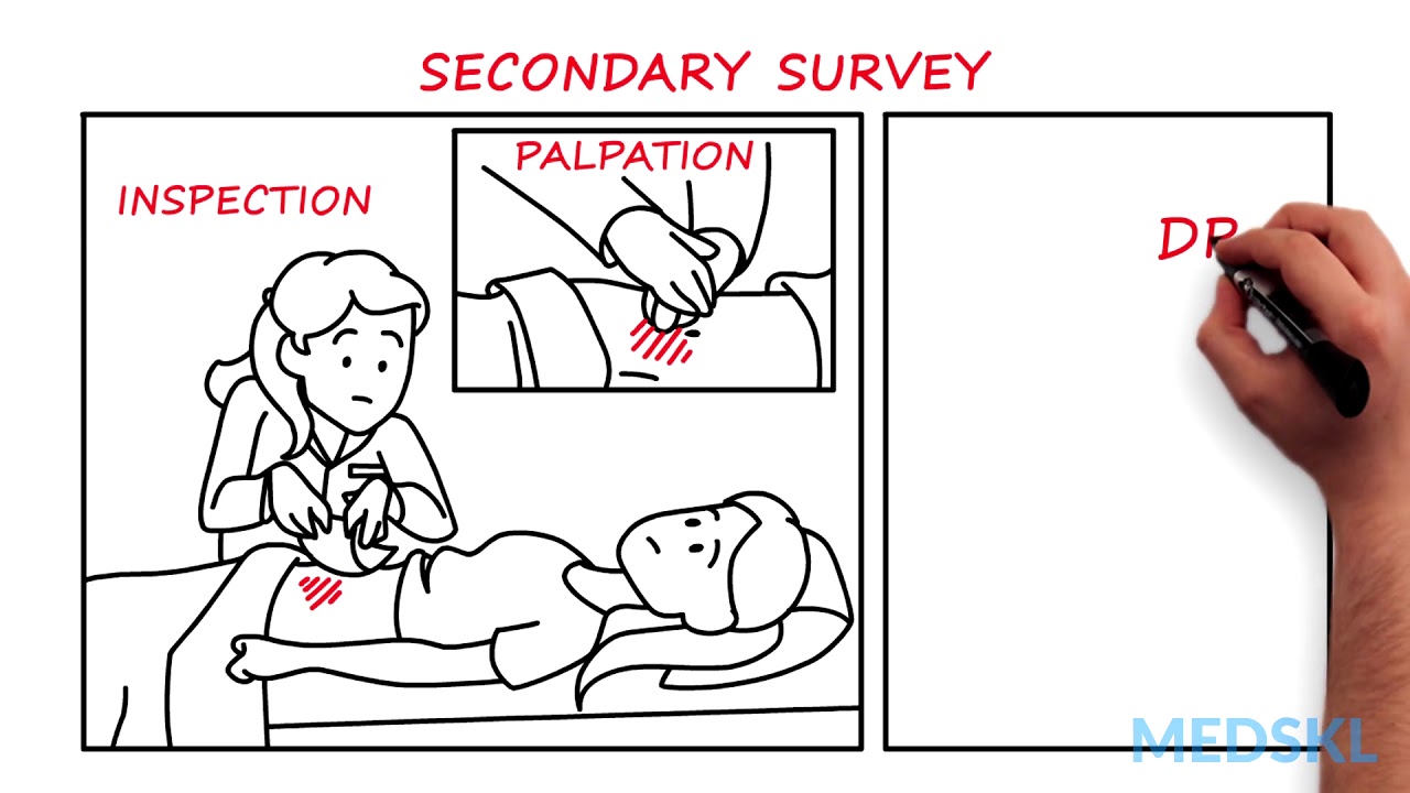 General Surgery – Abdominal Injuries: By Stephanie Mason M.D.