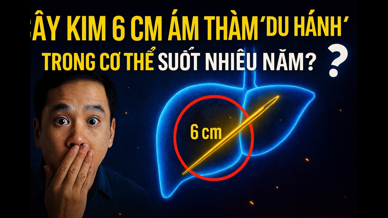 “CÂY KIM 6 CM ÂM THẦM ‘DU HÀNH’ TRONG CƠ THỂ SUỐT NHIỀU NĂM?”