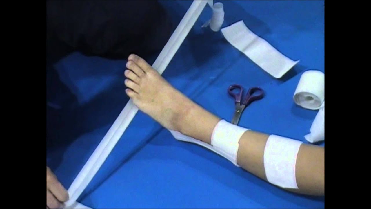 Traitement de l'entorse : Strapping de la cheville
