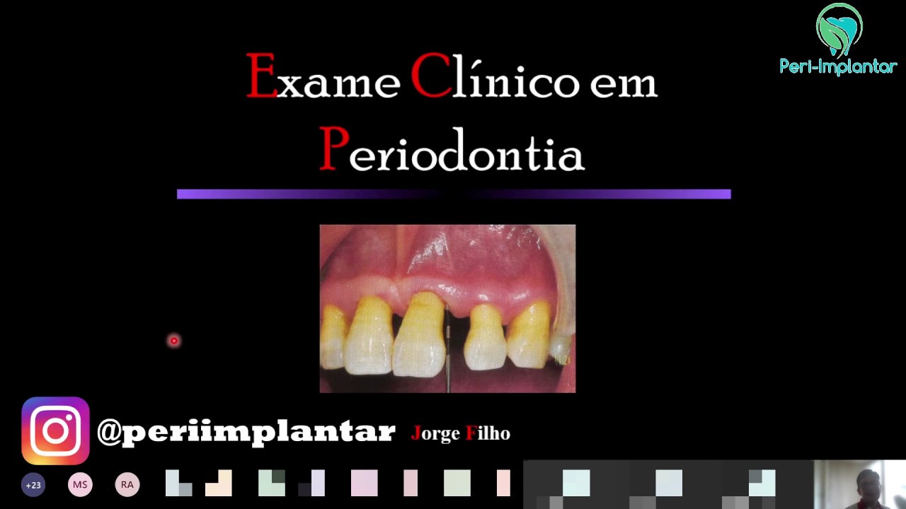 Descomplicando parâmetros clínicos periodontais