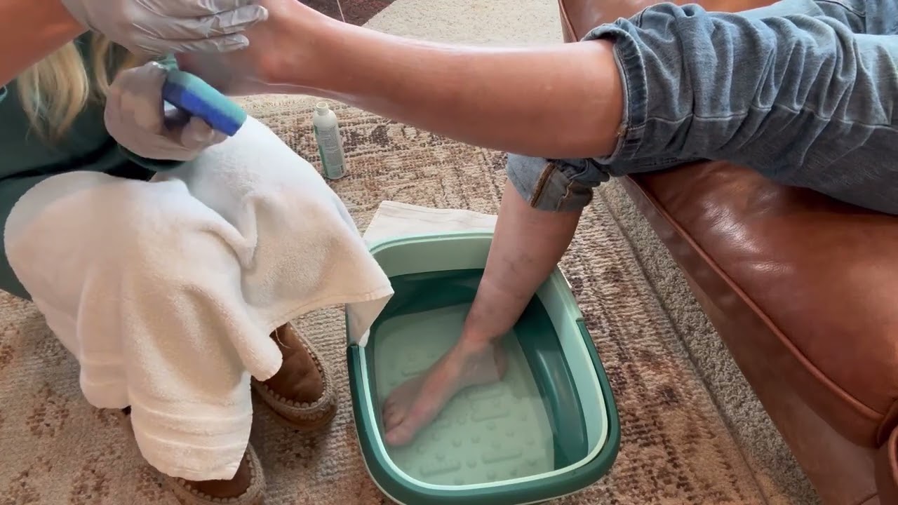 Ebanel Callus Remover Gel Review | #FootCare #AmazonFinds