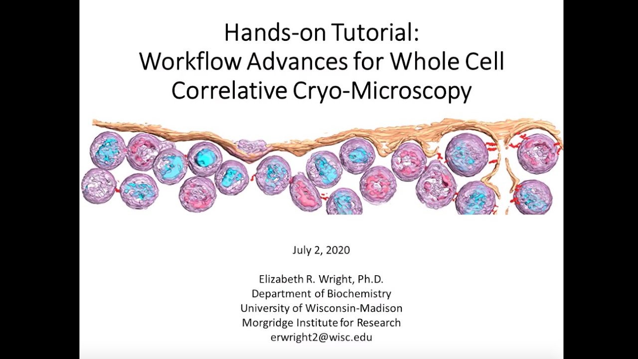 Cryo-CLEM webinar series: No2 - Workflow Advances for Whole Cell Correlative Cryo-Microscopy