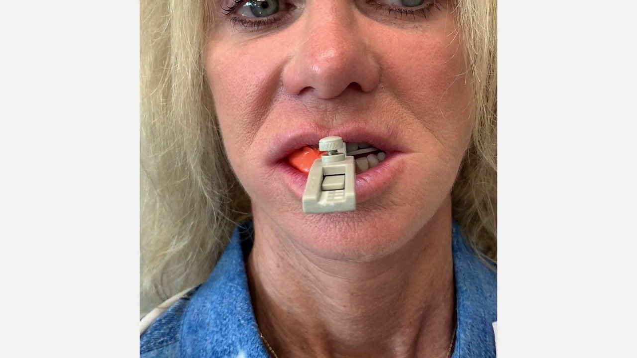 Taking a George Gauge Bite for Patients with Sleep Apnea, by Dr. Mitch Conditt
