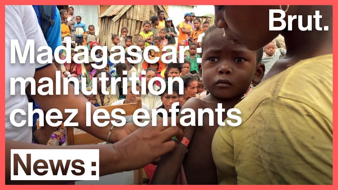 Madagascar : les enfants souffrent de malnutrition