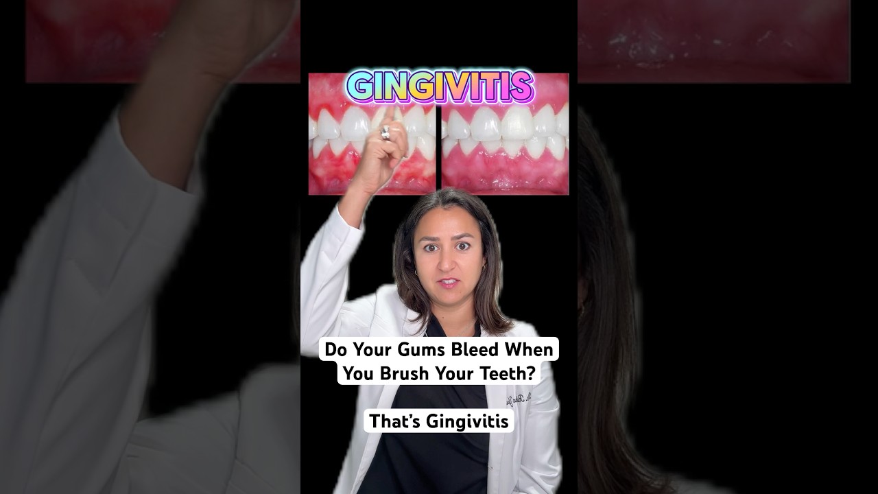 Do Your Gums Bleed When You Brush or Floss? It's Gingivitis 🚨 Periodontist, District Dental Surgery
