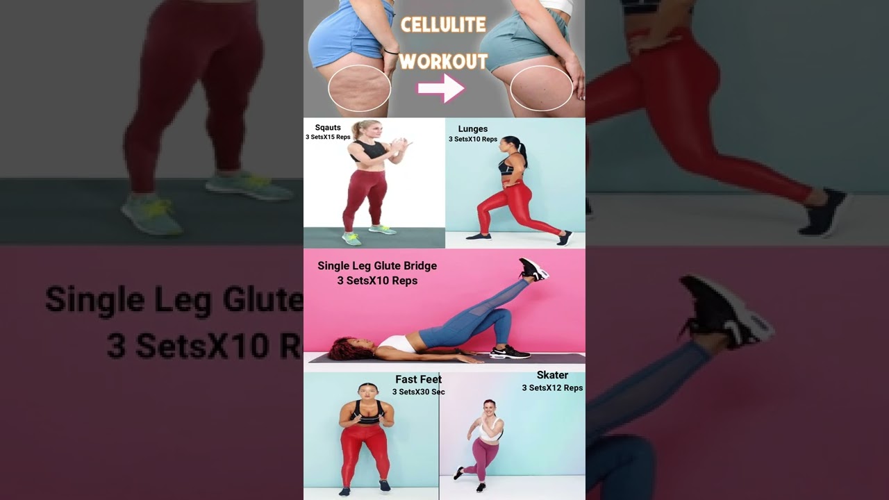 Reduce Cellulite | Cellulite Workout | Cellulite Exercise