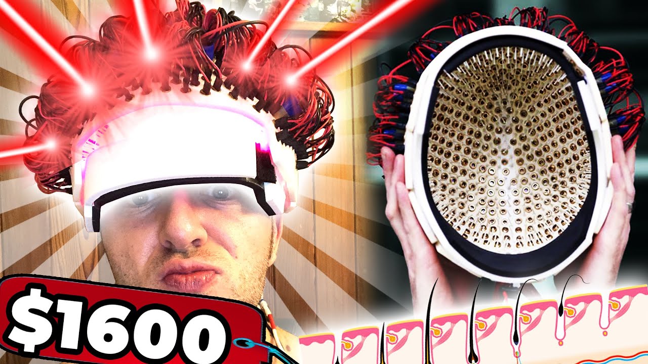 I Spent $1600 On A Custom Laser Helmet For Hair Loss Prevention And This Is What Happened…
