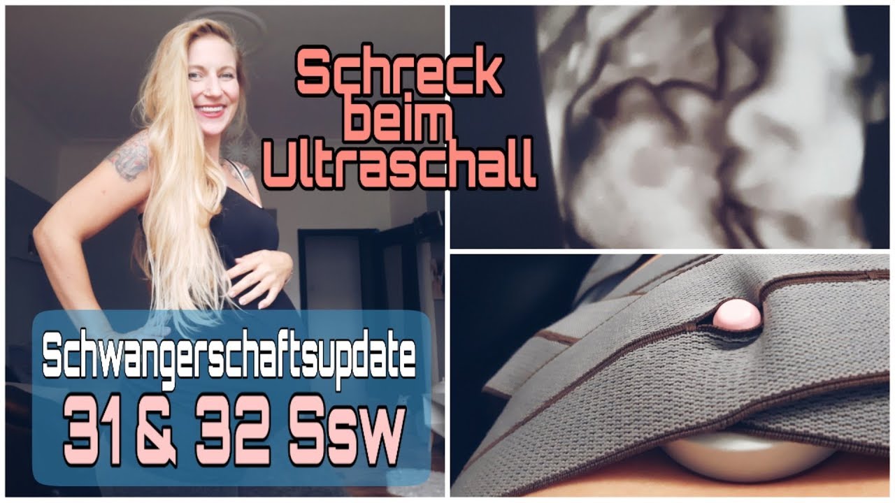 31 Ssw & 32 Ssw l Drittes Screening l Schwangerschaftsupdate 8 Monat