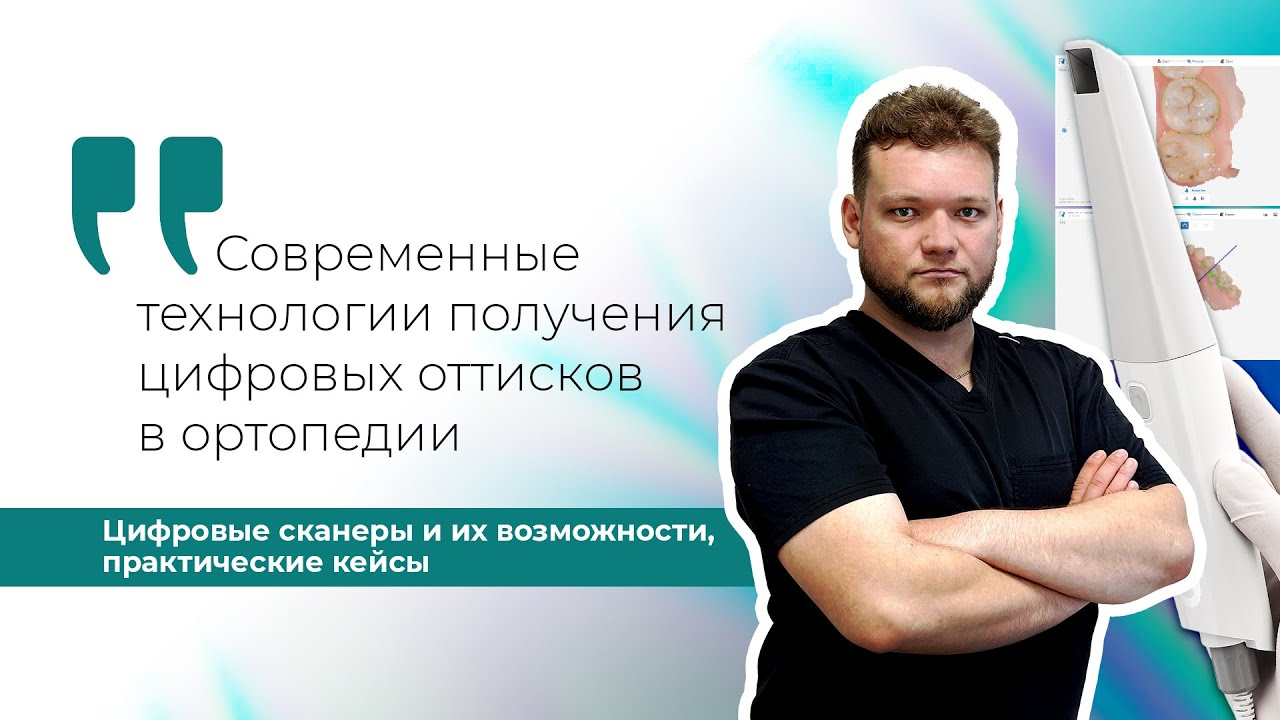 Современные технологии получения цифровых оттисков в ортопедии