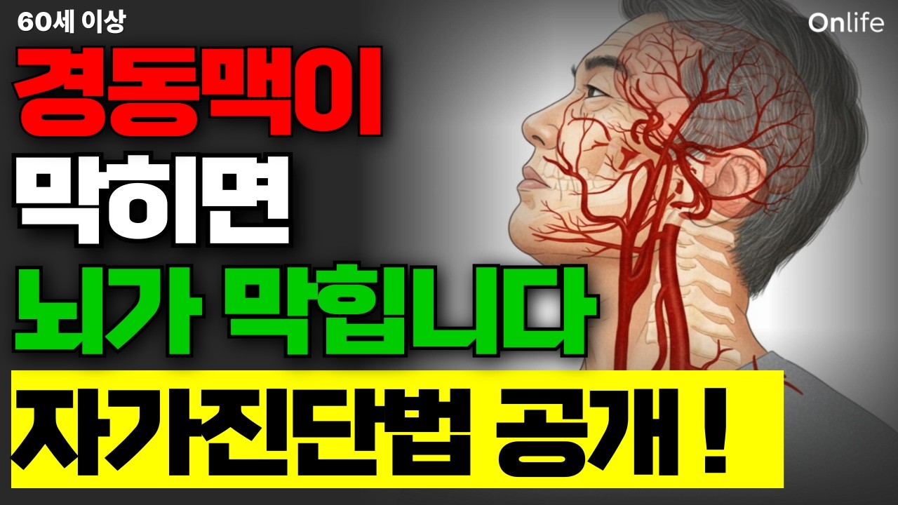 경동맥이 막히면 뇌가 멈춥니다, 3초 자가진단법
