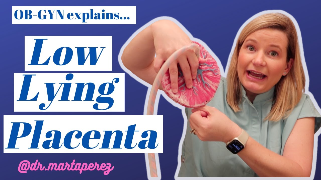Low Lying Placenta Explained: Risks, Sex, Exercise, C-section vs Vaginal birth, Marginal previa