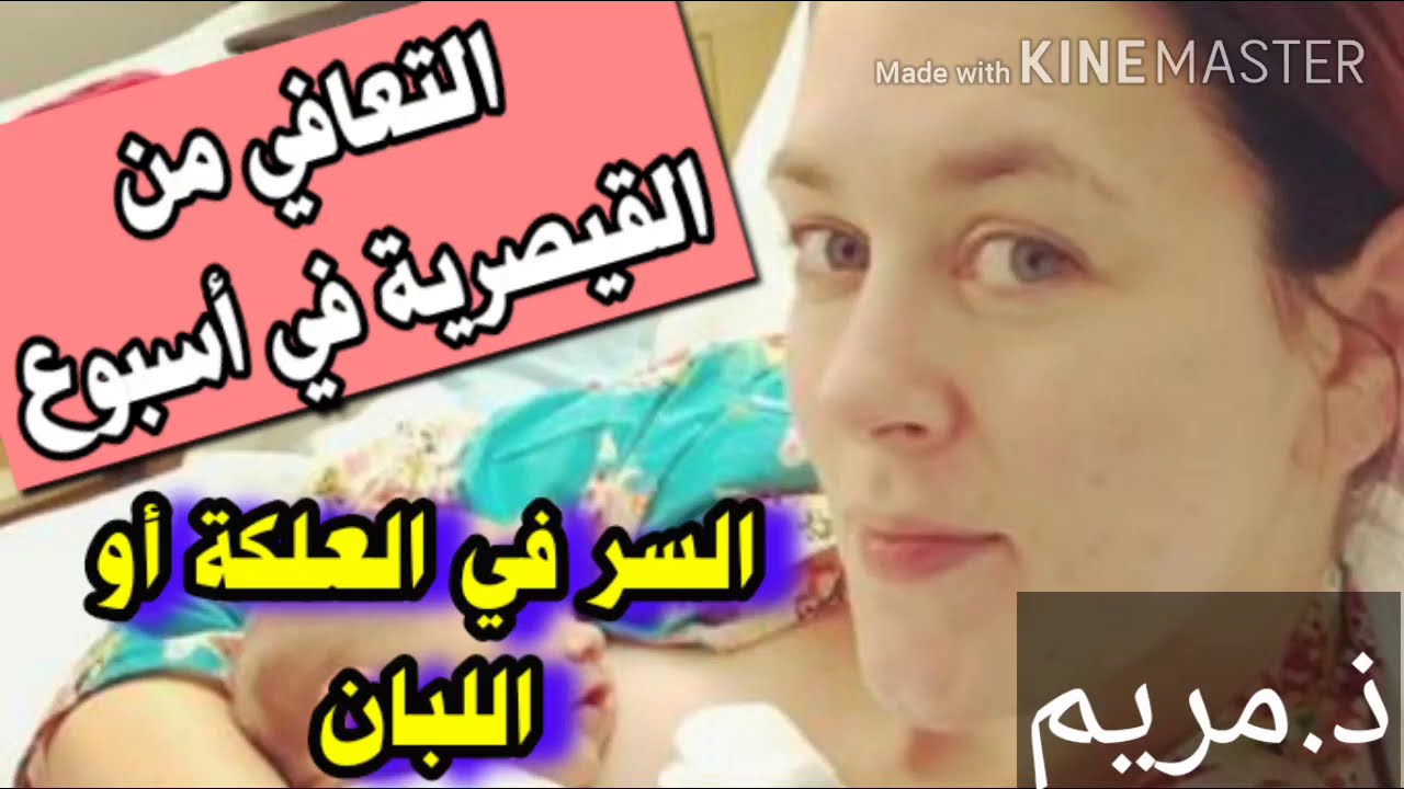 التعافي السريع من القيصرية في أسبوع عن طريق استعمال العلكة فقط 😱😱 سر أول مرة تكتشوع عن اللبان