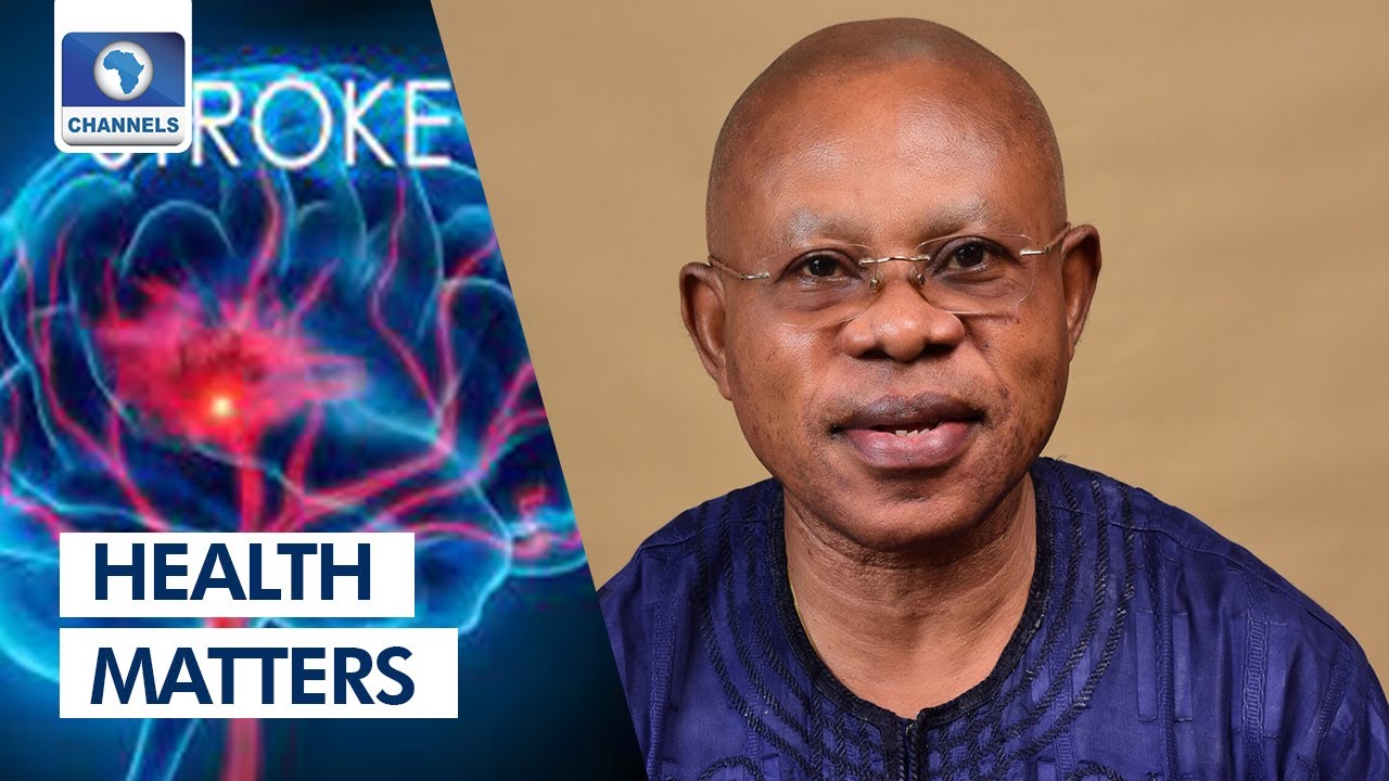 Consultant Physician Tips On How To Prevent Stroke | Health Matters