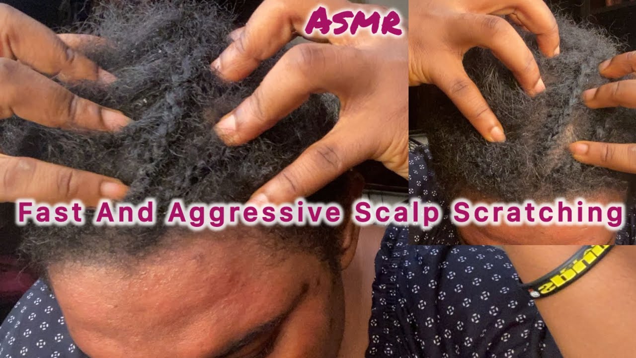 ASMR✨Fast And Aggressive Scalp Scratching #asmr #fastandaggressive #relax #scalpscratching #sleep