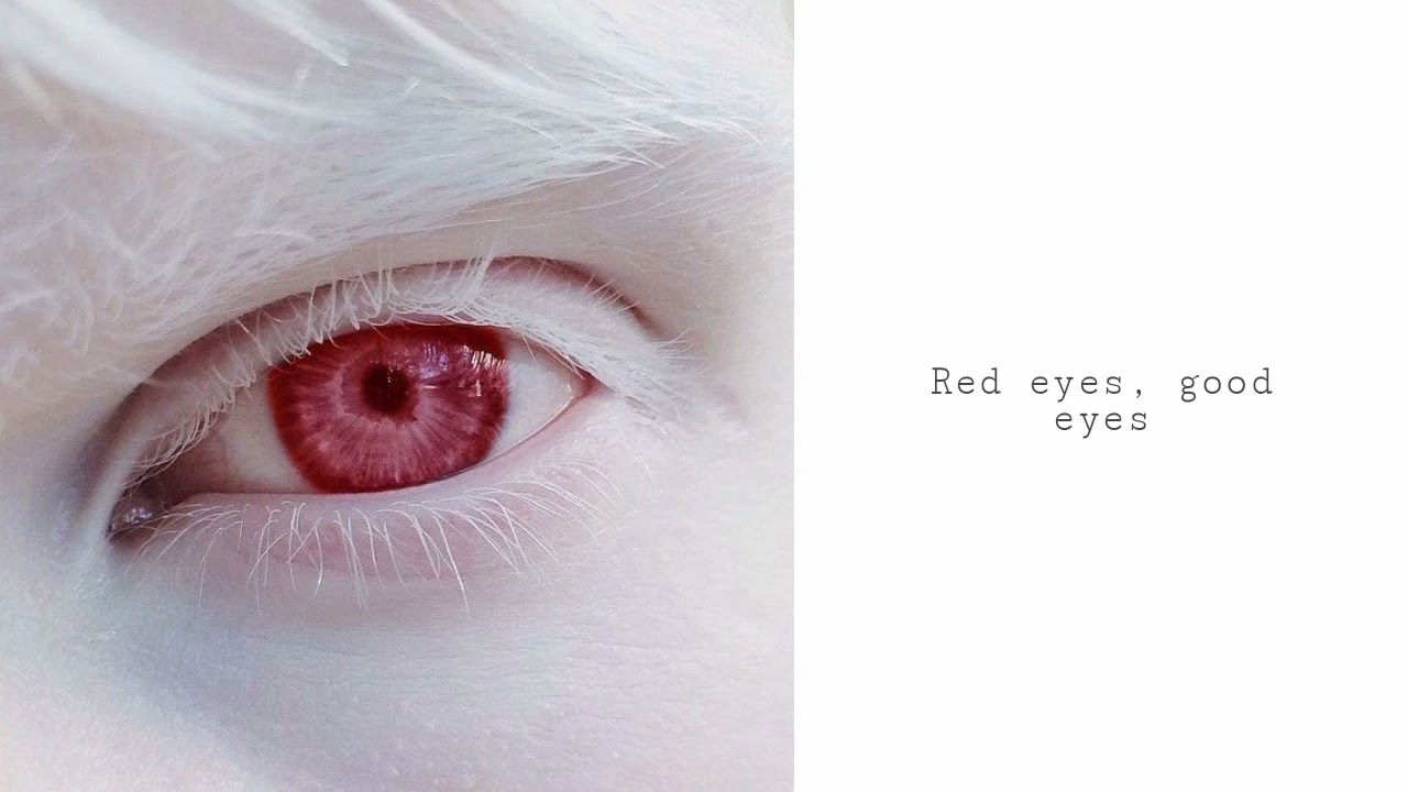 [🍑] Красные глаза, отличное зрение