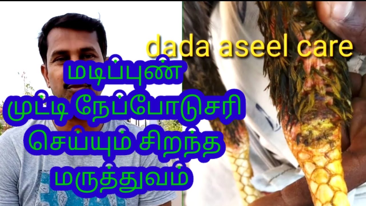 🪅வெயில் நாட்களில் வரும் ☎️மடிப்புண் உடுக்கி நெப்போடு 🩹🩺சரி செய்யும் இயற்கை மருத்துவம்📢🔊