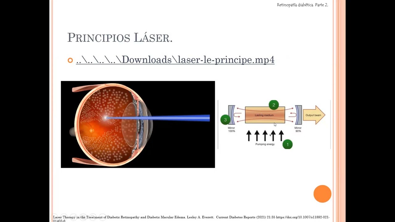 Evaluación y manejo del paciente con Retinopatía Diabetica II.