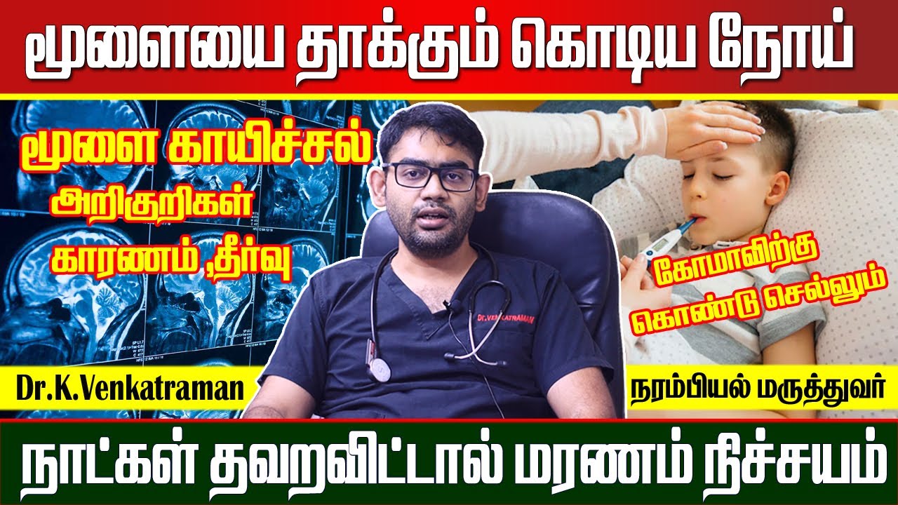 மூளைக்காய்ச்சல் ஏற்பட காரணம் | மூளை காய்ச்சலின் அறிகுறிகள் என்ன |  Brain Fever Symptoms in tamil