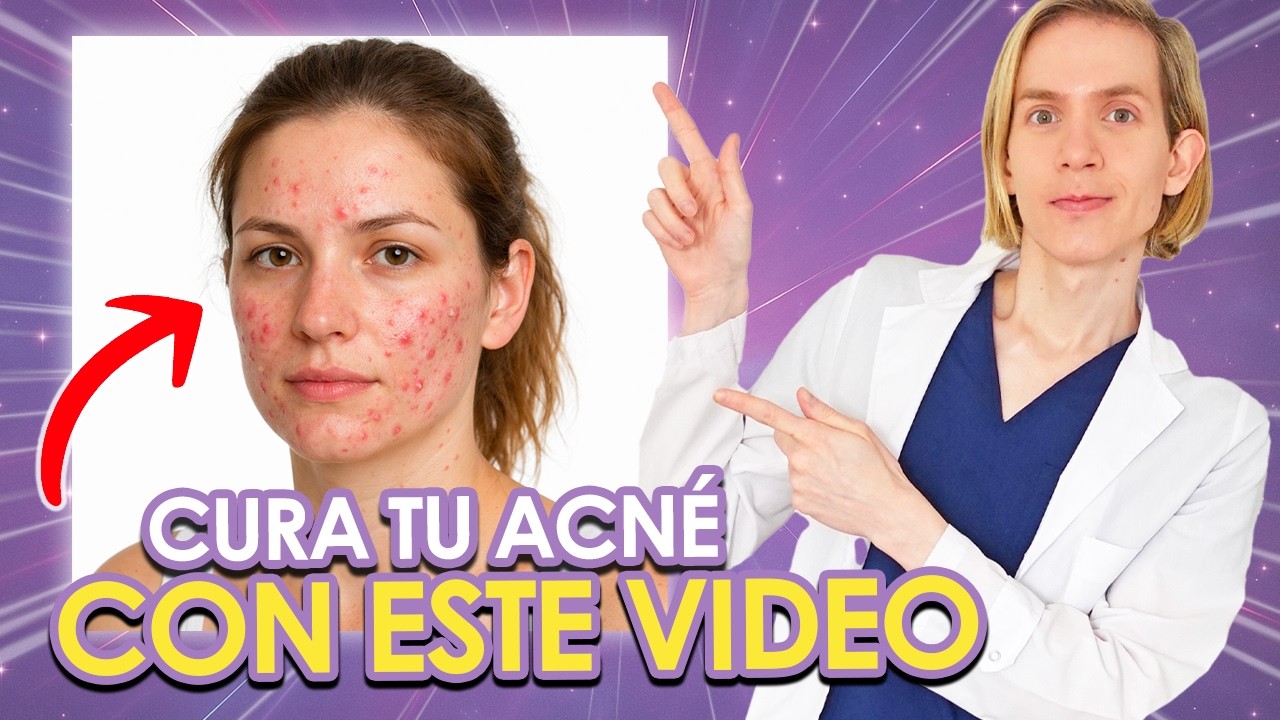COMO CURAR EL ACNÉ: Que usar, rutina de skincare, como sacar manchas y más