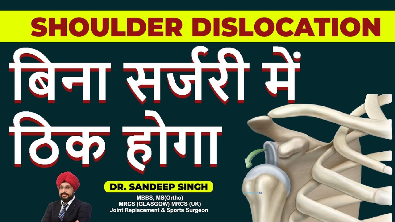 Shoulder Dislocation बिना सर्जरी मैं ठिक होगा || Shoulder Dislocation Treatment without Surgery