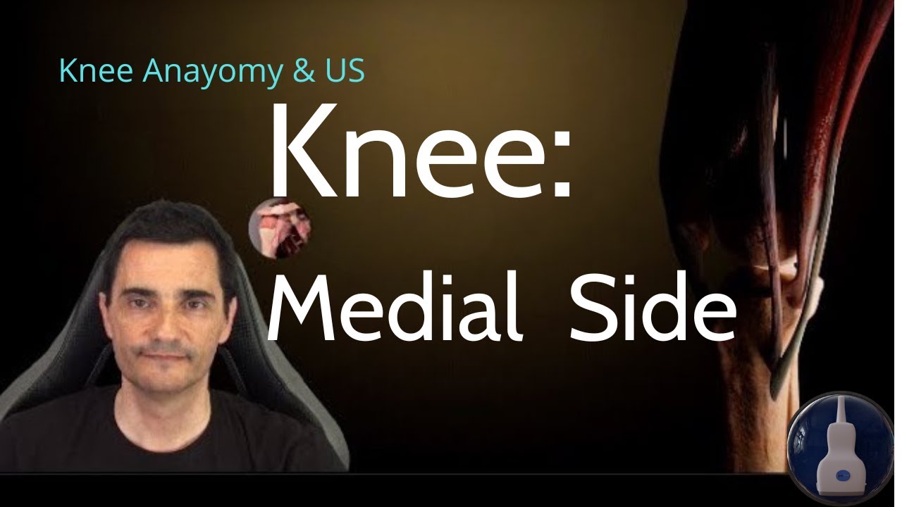 KNEE ULTRASOUND (PART 2/4) | Medial Side: Joint Line, MCL & Pes Anserinus