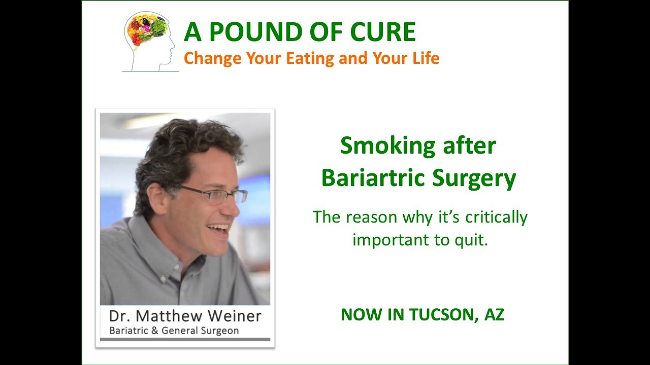 Smoking after Bariartric Surgery