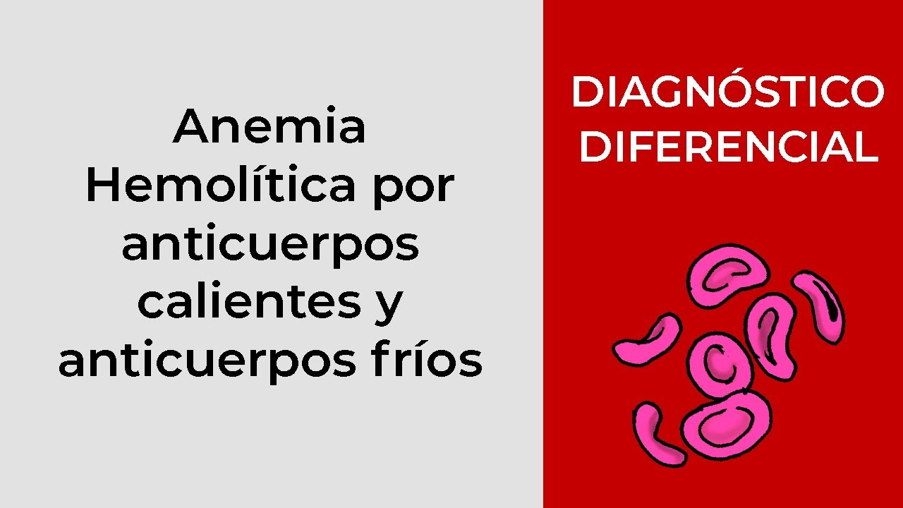 Diagnóstico diferencial. Anemia Hemolítica por anticuerpos calientes y anticuerpos fríos