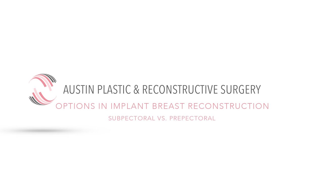 OPTIONS IN IMPLANT BREAST RECONSTRUCTION: Subpectoral vs. Prepectoral