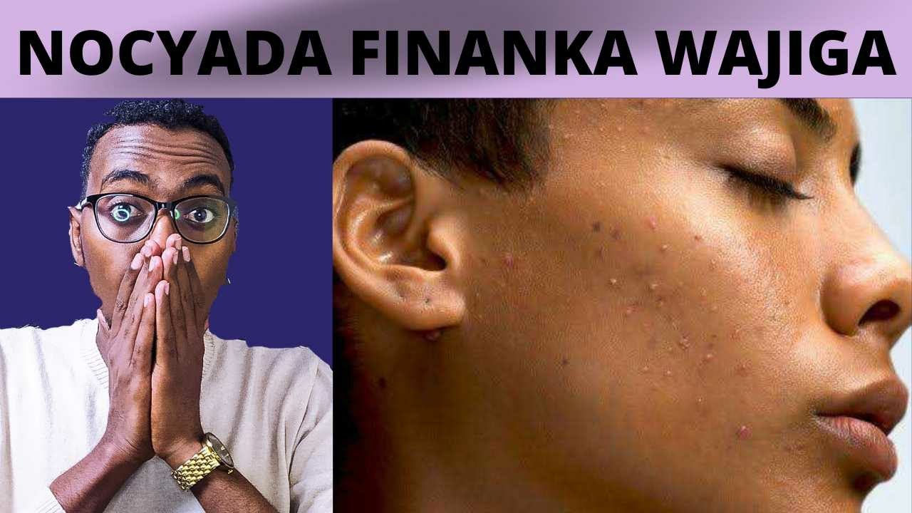 Nocyada Finanka Wajiga iyo Sida looga Hortago!!!