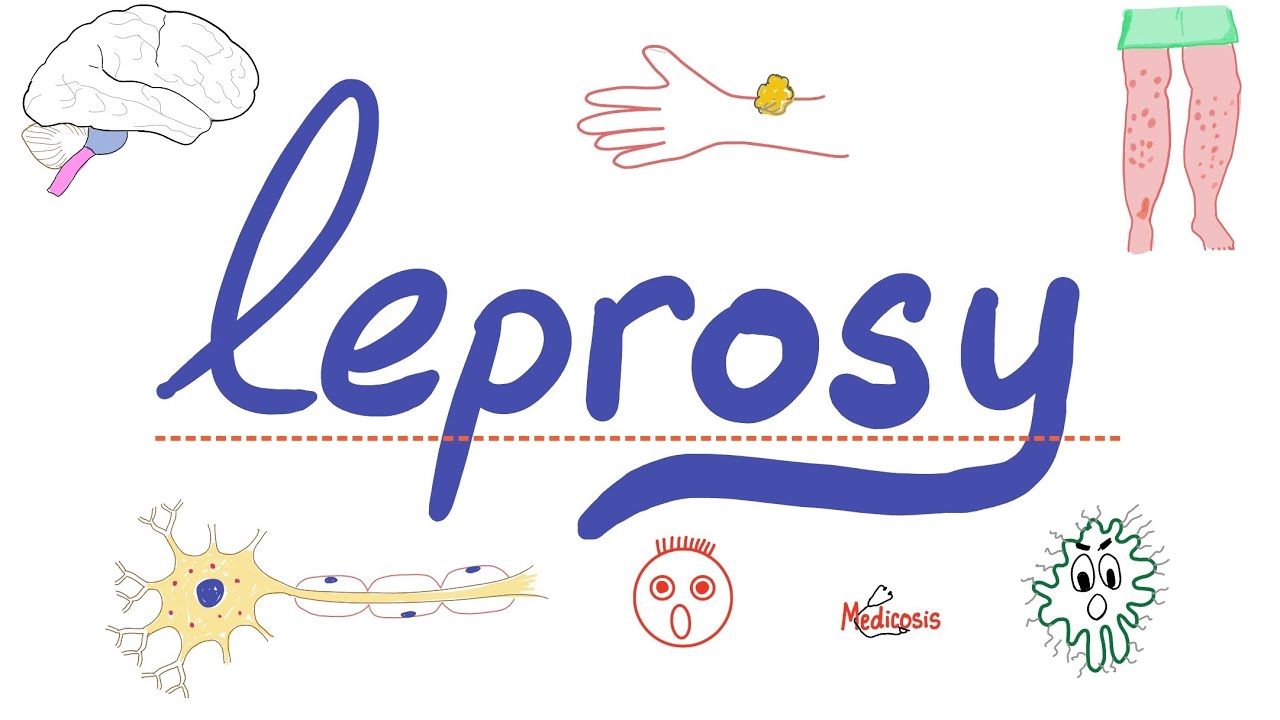 Leprosy (Hansen Disease) - Mycobacterium leprae - Microbiology 🧫 & Infectious Diseases