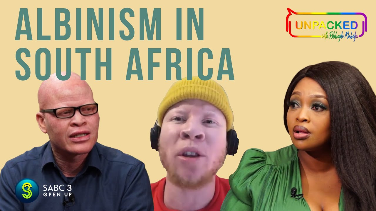 Albinism | Unpacked with Relebogile Mabotja - Episode 13 | Season 2