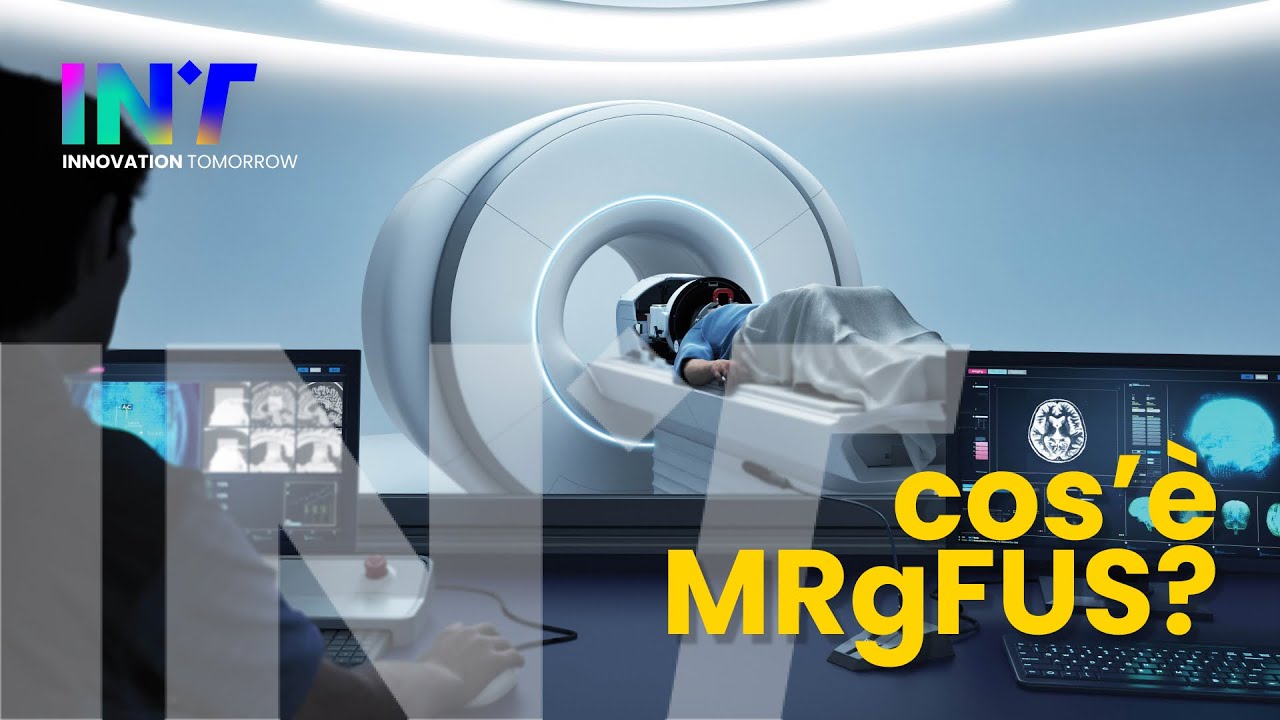 MRgFUS: la tecnologia all’avanguardia che ferma il tremore