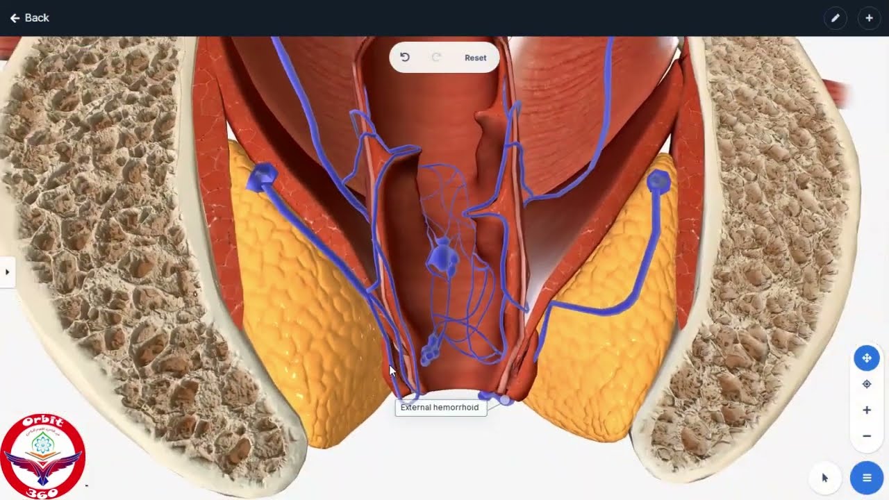 Hemaroid 3d/large intestine diseases/symptoms and treatment of Hemaroid/mbbs prof1/nmdcat/neet/jee/