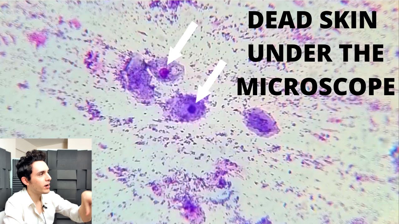 UPDATE Dead Skin Under The Microscope (Part 2)