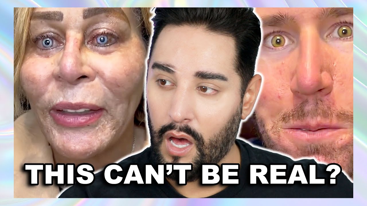 Permanent Eye Color Surgery Gone Very Wrong