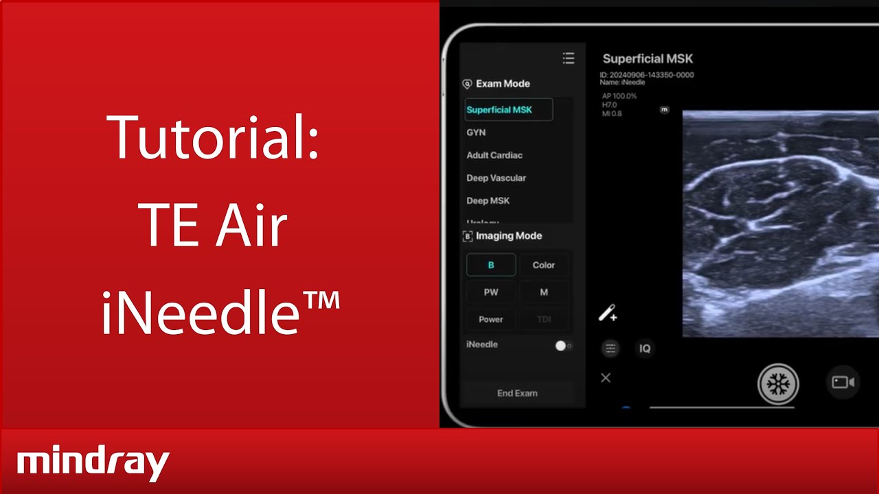 TE Air Tutorial-iNeedle