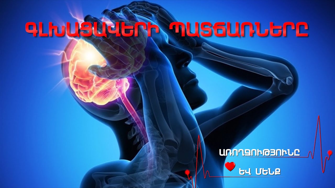 Առողջությունը և մենք 6 - Գլխացավերի Պատճառները