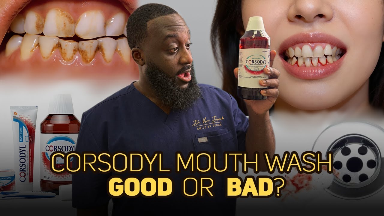 Corsodyl Mouthwash: Good or Bad? 🤷🏿‍♂️ (Dentist Explains